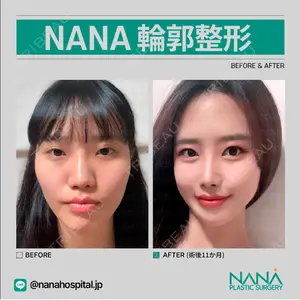 NANA（ナナ）美容外科の症例
