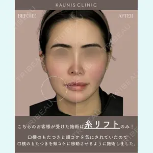 KAUNIS CLINIC（カウニスクリニック） 本山 文医師の症例