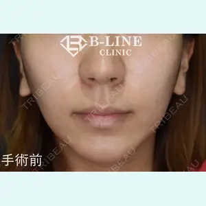 B-LINE CLINIC 池袋院 小池 康弘医師の症例