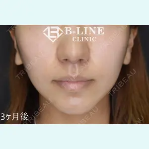 B-LINE CLINIC 池袋院 小池 康弘医師の症例