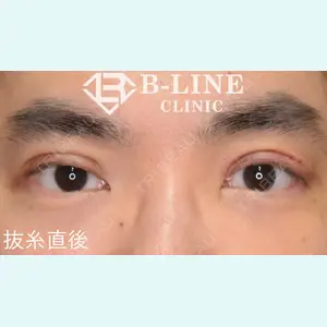 B-LINE CLINIC 池袋院 小池 康弘医師の症例