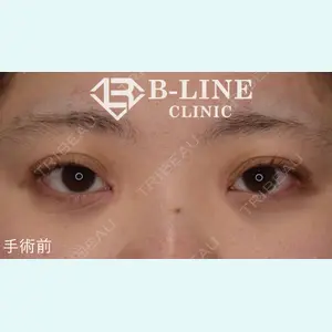 B-LINE CLINIC 池袋院 小池 康弘医師の症例