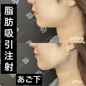 EMMO FACE CLINIC 大阪梅田院 山﨑 冴羅医師の症例