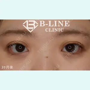 B-LINE CLINIC 池袋院 小池 康弘医師の症例