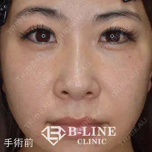 B-LINE CLINIC 池袋院 小池 康弘医師の症例