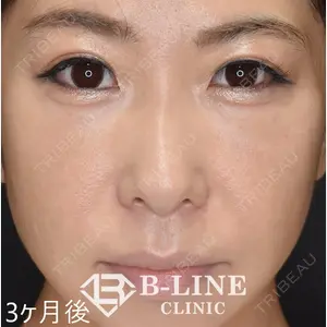 B-LINE CLINIC 池袋院 小池 康弘医師の症例