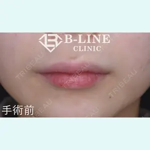 B-LINE CLINIC 池袋院 小池 康弘医師の症例