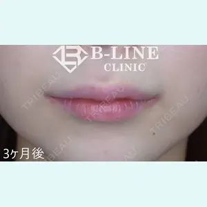 B-LINE CLINIC 池袋院 小池 康弘医師の症例