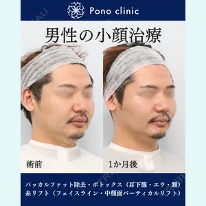 Pono clinic 【ポノクリ】 百瀬直也医師の症例