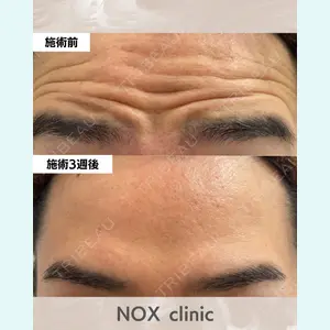 NOX clinic 金子 雅人医師の症例