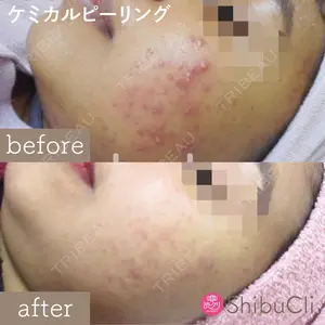 渋谷美容外科クリニック 新宿院の症例