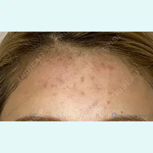 Original Beauty Clinic GINZA 佐藤玲史医師の症例