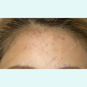 Original Beauty Clinic GINZA 佐藤玲史医師の症例