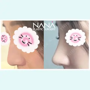 NANA（ナナ）美容外科 イ・スンジェ医師の症例