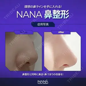 NANA（ナナ）美容外科の症例