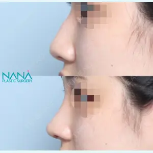 NANA（ナナ）美容外科 ソン・スンゼ医師の症例