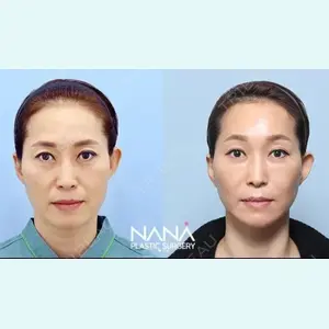 NANA（ナナ）美容外科 キム・イルファン医師の症例