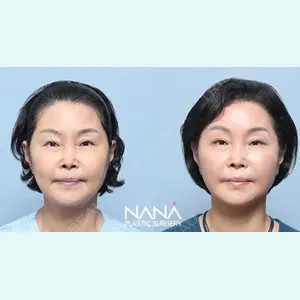 NANA（ナナ）美容外科 キム・イルファン医師の症例