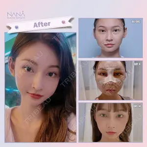 NANA（ナナ）美容外科 キム・ユンホ 医師の症例