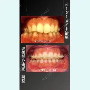 IZUMI矯正歯科・IZUMI鍼灸院 村上 静花医師の症例