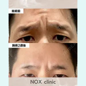 NOX clinicの症例