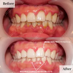 IZUMI矯正歯科・IZUMI鍼灸院の症例