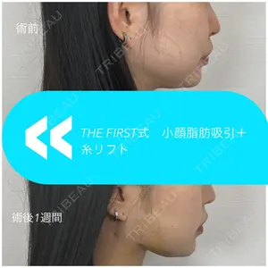 THE FIRST CLINIC 多摩センター院 惟村 公郁医師の症例