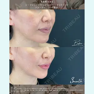 湘南美容クリニック 松戸院の症例