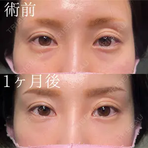 HAAB×DREAM BEAUTY CLINIC 大阪梅田院 鈴木 馨斗医師の症例
