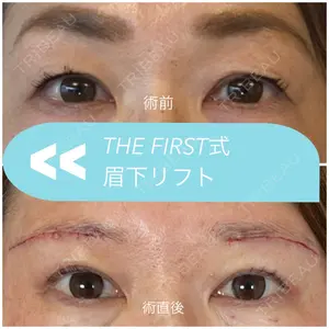 THE FIRST CLINIC 多摩センター院 惟村 公郁医師の症例