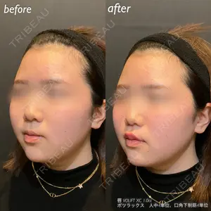 DMTC美容皮膚科 日本橋院 山中大介医師の症例