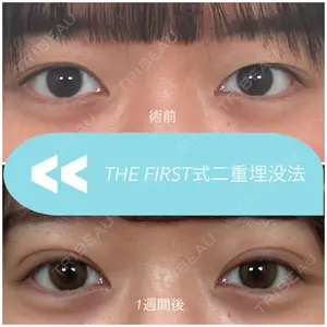 THE FIRST CLINIC 多摩センター院 惟村 公郁医師の症例