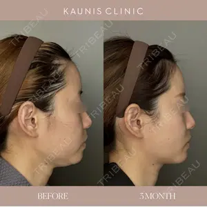 KAUNIS CLINIC（カウニスクリニック） 本山 文医師の症例
