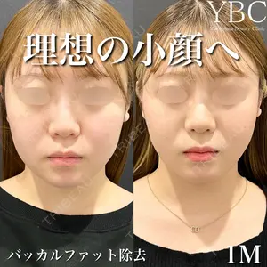 YBC横浜美容外科 大宮院 磯村 亮輔医師の症例