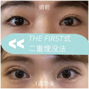 THE FIRST CLINIC 多摩センター院 惟村 公郁医師の症例