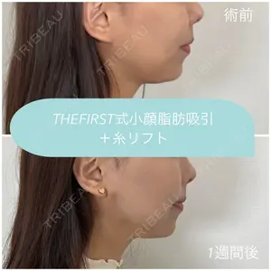 THE FIRST CLINIC 多摩センター院 惟村 公郁医師の症例