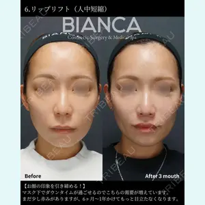 BIANCA銀座 堀田 和亮医師の症例