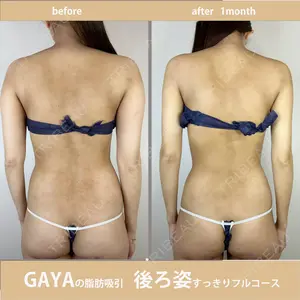 GAYA body design clinicの症例