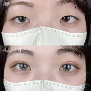 AI Beauty Clinic （エーアイ美容クリニック） 小林 里佳医師の症例