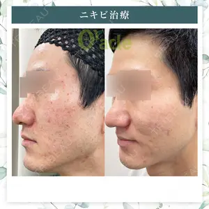 オラクル美容皮膚科 名古屋院の症例