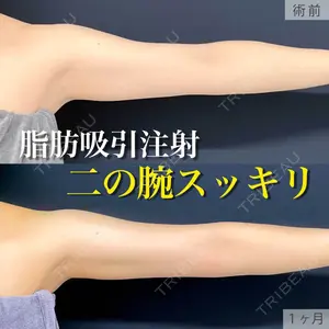 東京シンデレラ美容外科 新宿院 吉原 伯医師の症例