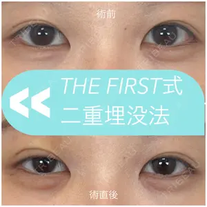 THE FIRST CLINIC 多摩センター院の症例