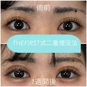 THE FIRST CLINIC 多摩センター院 惟村 公郁医師の症例