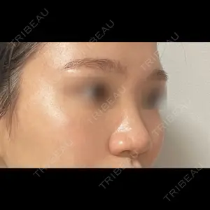 LUHO（ルホ）美容外科 キム・ジュンヨン医師の症例
