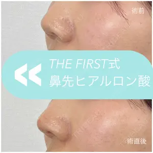 THE FIRST CLINIC 多摩センター院 惟村 公郁医師の症例