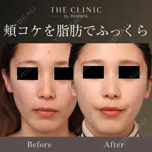 THE CLINIC（ザ・クリニック）東京院 村田 八千穂医師の症例