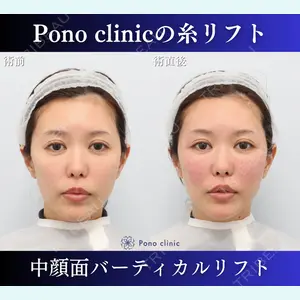 Pono clinic 【ポノクリ】 百瀬直也医師の症例