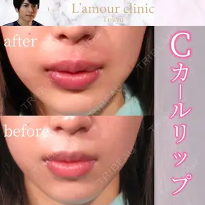 L‘amour clinic Tokyo【ラムールクリニック東京】の症例