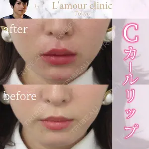 L‘amour clinic Tokyo【ラムールクリニック東京】の症例