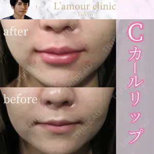 L‘amour clinic Tokyo【ラムールクリニック東京】の症例